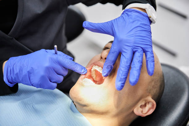 Best Emergency Denture Repair in Michigan City, IN